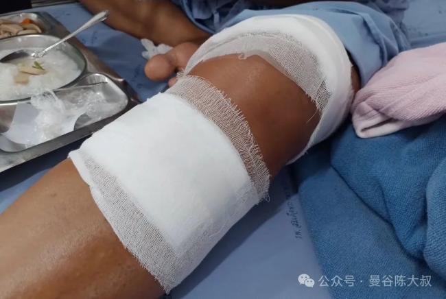 硬核大姐徒手干掉眼镜王蛇 拎蛇尸冲进医院